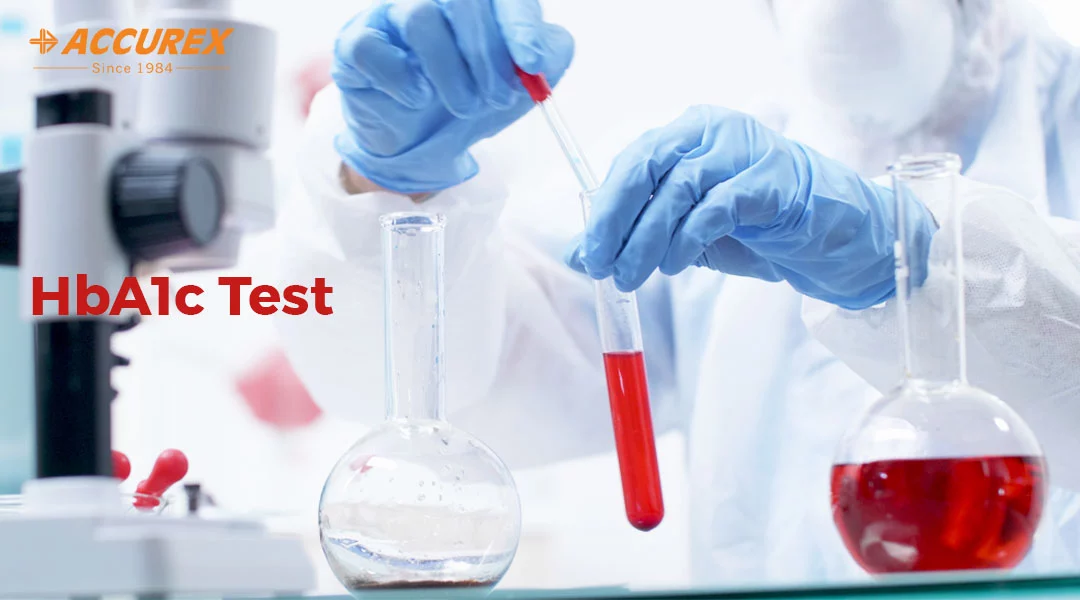 hemoglobin-a1c-hba1c-hba1c-test-poc-testing