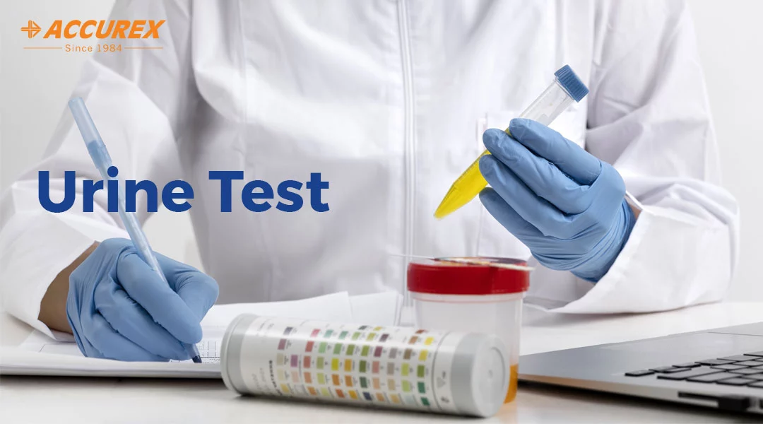 Urine Test | Urinalysis | Types of Urine Tests & its Uses