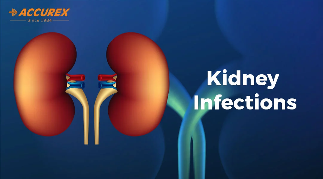 Kidney Infections Symptoms Causes Diagnosis Treatment